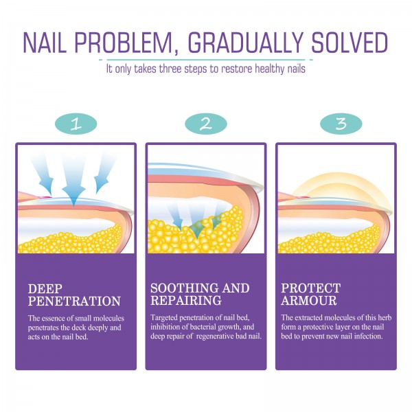 سبراي لاصلاح وتهذيب الاظافر