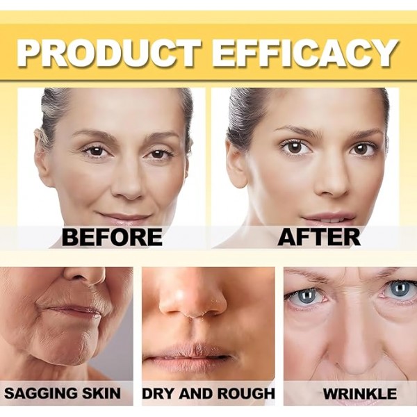 botox bee venom Cream عرض قطعتين